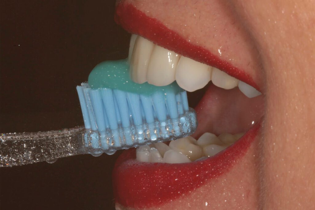 facetas, lentes de contato e resina composta