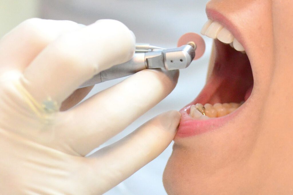 resina odontológica